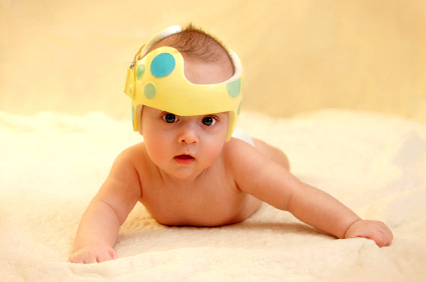 Bayi dengan helm kepala datar