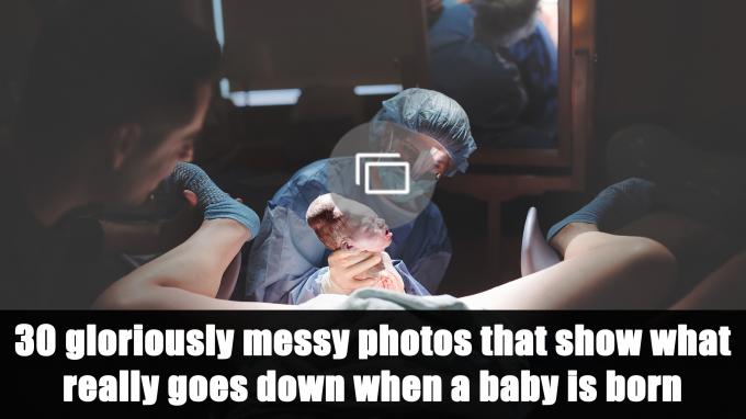 fotky z porodu
