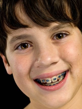 Kind mit Zahnspange