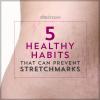 5 způsobů, jak bojovat proti striím během těhotenství, než začnou - SheKnows