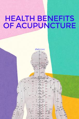 Az akupunktúra egészségügyi előnyei